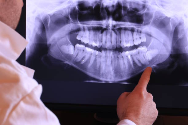 Best Broken or Chipped Tooth Repair in Des Peres, MO