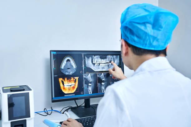 Best Knocked-Out Tooth (Avulsed Tooth) Treatment in Des Peres, MO